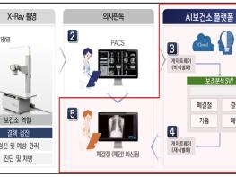 세종시, AI보건소로 폐질환 조기발견 새지평 연다 기사 이미지